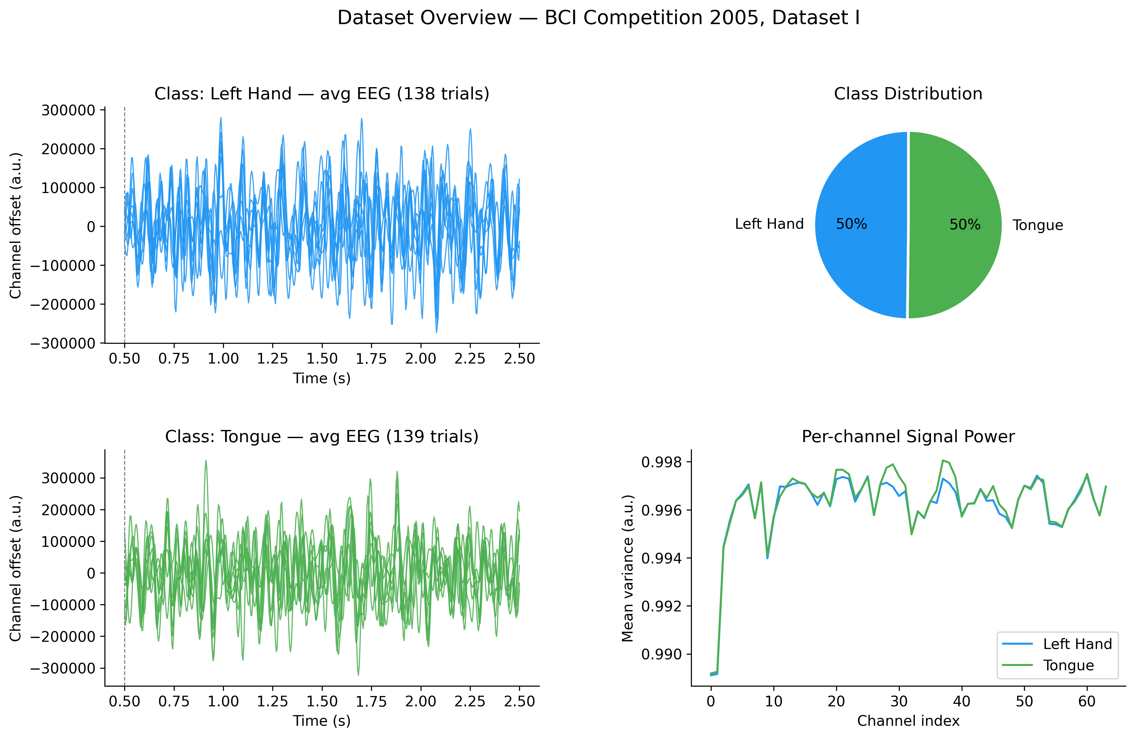EEG data overview