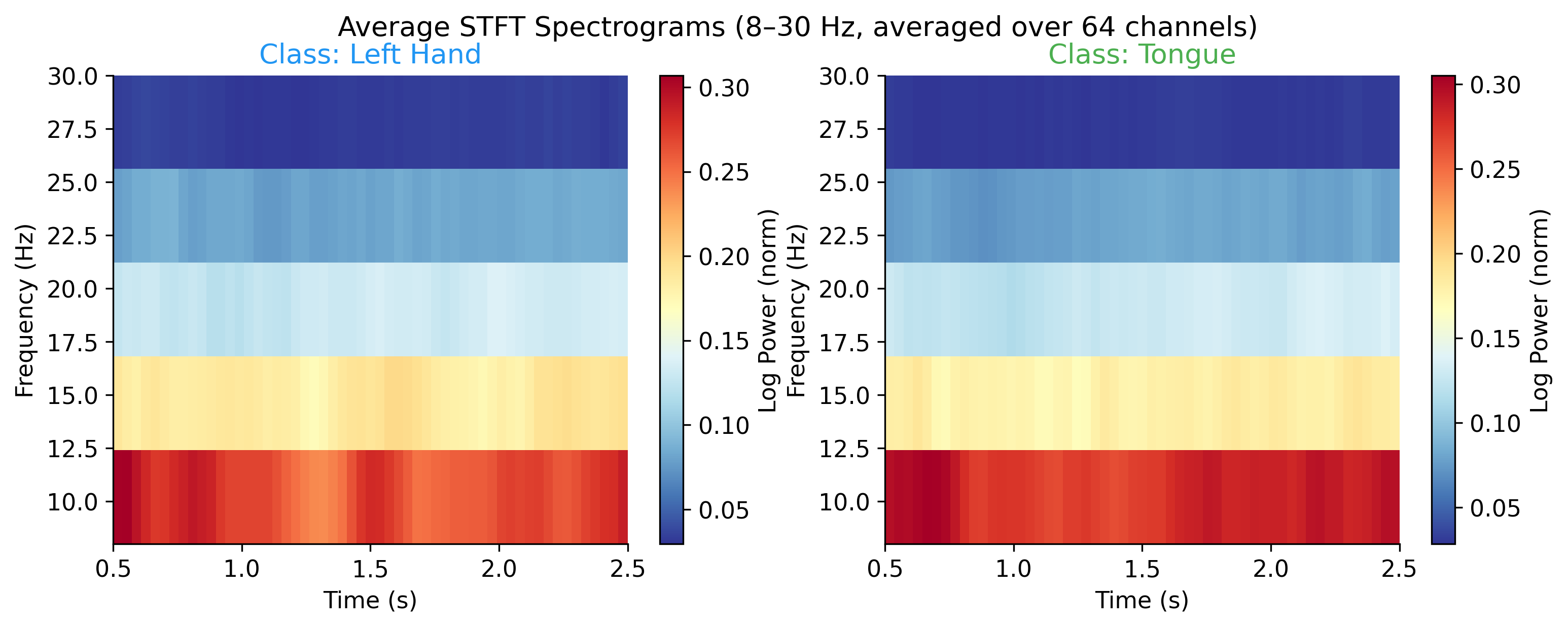 EEG spectrograms